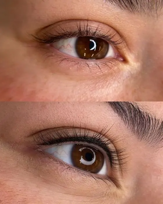 Antes y después de línea entre pestañas